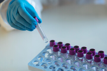 Process of coronavirus testing examination by nurse medic in laboratory lab, COVID-19 swab collection kit, test tube for taking OP NP patient specimen sample, patient receiving a corona test