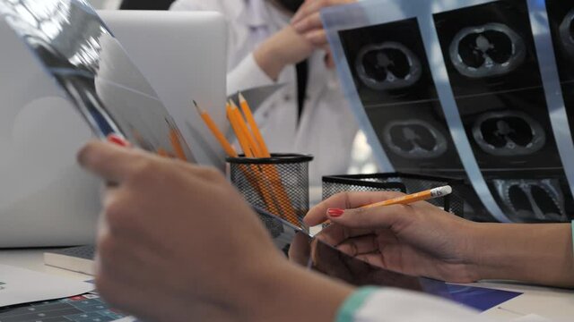 A team of highly qualified doctors discuss lung x-rays at a modern clinic. Close-up of doctors hands in hospital.