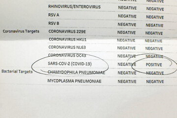 A positive test result for Covid 19