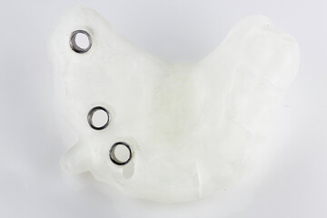 dental template with titanium sleeves for implantation on a white background, top view