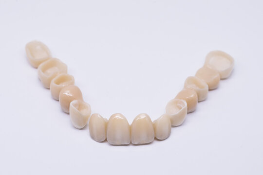 Beautiful dental bridge isolated on wite made of ceramic porcelain. Aesthetic restoration of tooth loss. Ceramic zirconium in final version. Metal Free Ceramic Dental Crowns