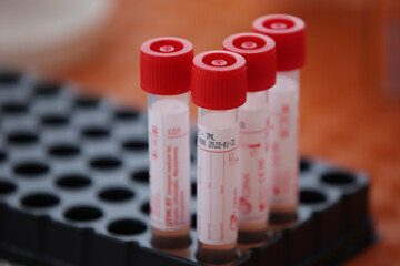 TAMPONE CORONAVIRUS  © fabio murru