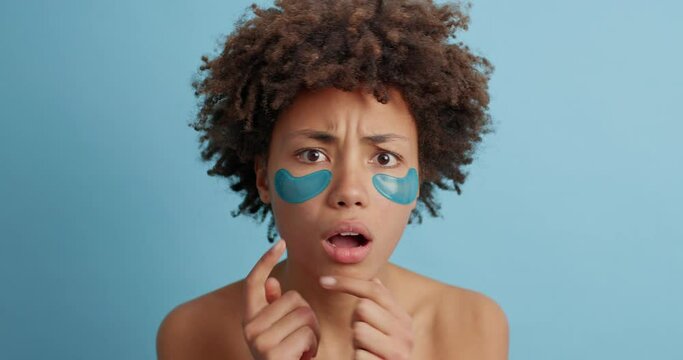 Disappointed female model has acne problem squeezes pimples on face applies beauty patches for skin rejuvenation has sad expression poses shirtless indoor against blue background. Dermatology concept