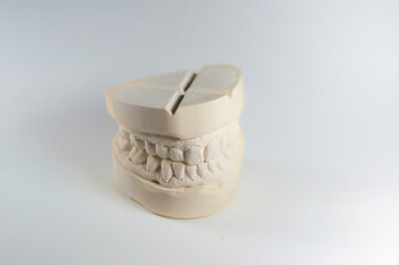 Zahnabdruck Zahnmedizin