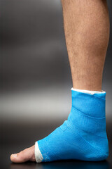 Close up photos of foot blue splint for treatment of injuries from ankle sprain.