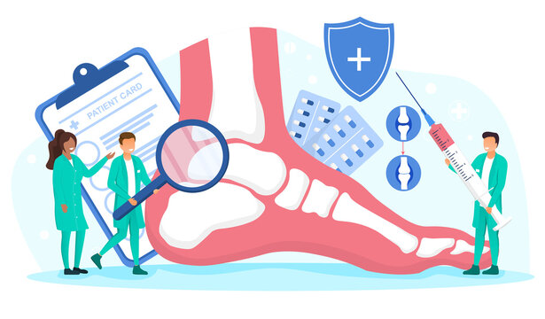 Diverse multiracial orthopedics doctors examining foot. Bone treatment abstract concept. Male doctor using magnifier to find bone broblem. Human anatomy, foot part. Flat cartoon vector illustration