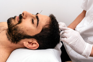 Obraz na płótnie Canvas Man Receiving Acupuncture Treatment