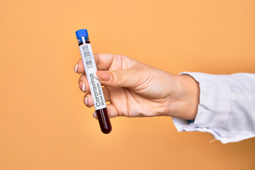 Obraz premium Hand of caucasian young woman holding tests tube with coronavirus results over isolated yellow background