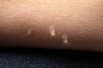 Water drops on arm skin, close up of wet human skin texture