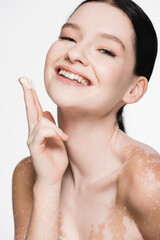 Obraz na płótnie Canvas smiling young beautiful woman with vitiligo applying cosmetic cream isolated on white