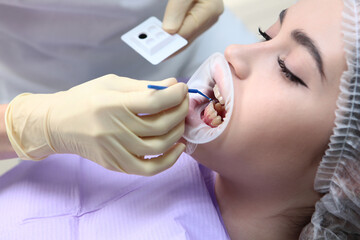 The dentist applies a contrast gel to the teeth of a young patient. Professional hygiene of the...