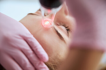Caucasian female getting a laser skin treatment - obrazy, fototapety, plakaty