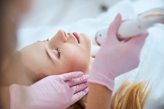 Blonde woman receiving the fractional microneedling treatment