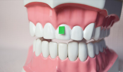 Green vegetables on the upper teeth model.Dental care demonstration.Dental care concept.