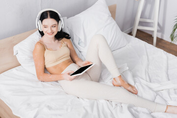 happy woman with vitiligo in wireless headphones holding digital tablet with blank screen in bedroom
