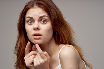 Fototapeta premium woman with loose hair acne on her face acne gesturing with her hands