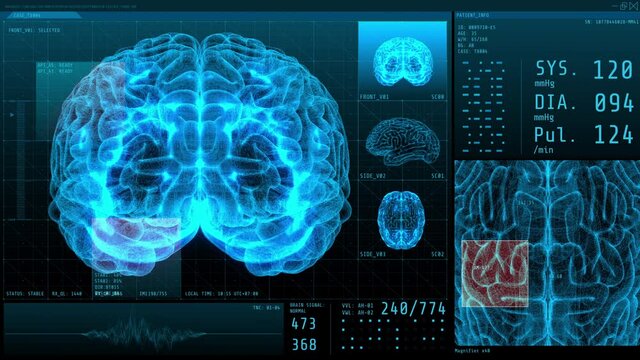 3D Brain and vital signs with statistical data neurology display