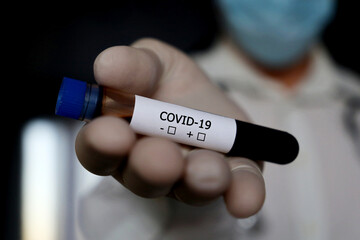 Test tube with covid-19 blood sample in male hand close up. Doctor or scientist with coronavirus test