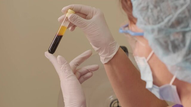 Platelet-Rich plasma preparation. Tube with blood in hands. Centrifuge. Background