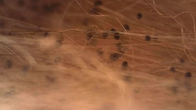 Microscope Mold Sporangiospore 1000x Pan R Biology Fungi