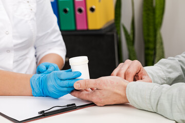 The dermatologist examines the skin of the patient the patient holds in his hands a cure for the belezney. Examination and diagnosis of skin diseases-allergies, psoriasis, eczema, dermatitis.