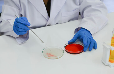 Asian female scientist doctor working in to research and concentrated making the staphylococcus aureus in laboratory