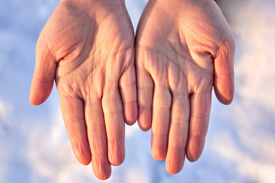 Dry female hands in winter on a background of snow.