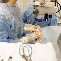 ophthalmologist doctor lenses vision eyes operation cataract injection syringe hand