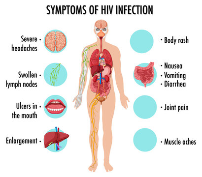 Symptoms of HIV infection infographic