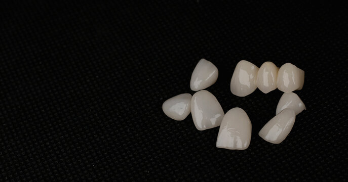 dental laminate veneers, zirconia ceramic crowns