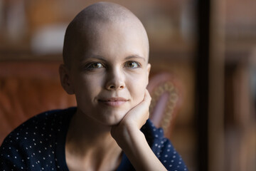 Head shot portrait sick hairless woman looking at camera, young female patient struggling with...