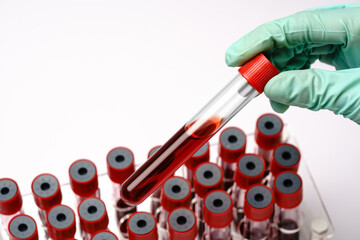 hands of a lab technician with a test tube of blood sample and a rack with other samples over light grey background