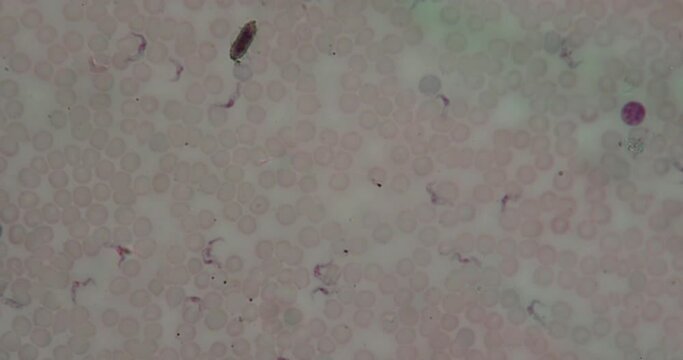 Trypanosoma pathogen under the microscope 100x