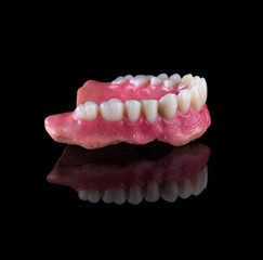 Complete maxillary denture – Wax-Up and Gingival Contouring