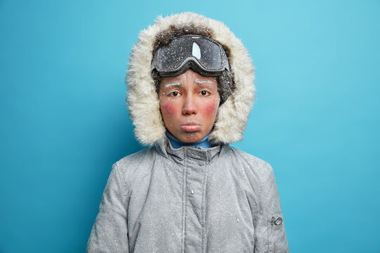 Photo of frustrated frozen woman has rdd face covered with hoarfrost spends time outdoor during frosty winter day wears snowboarding goggles and warm thermo jacket isolated over blue background