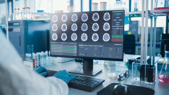Advanced Brain Research Laboratory: Neurology Scientist is Using Personal Computer Showing MRI, CT Scans with Brain Images. Modern Laboratory Working on Brain Research, Developing Vaccine, Drugs.