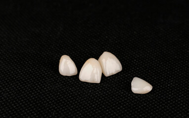 dental ceramic crowns, laminate veneers.