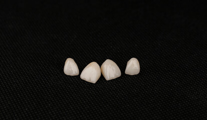 dental ceramic crowns, laminate veneers.