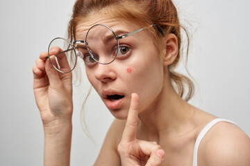 woman in glasses shows a finger to a red pimple on her face