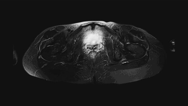 Voluminous color MRI of the female pelvic organs, abdominal cavity, gastrointestinal tract and bladder