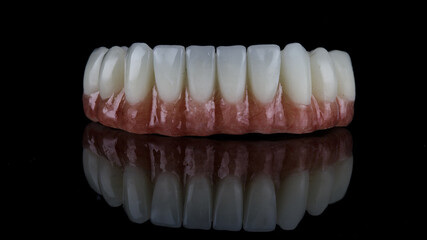 dental prosthesis of the lower jaw with natural gingiva with creative reflection on black glass