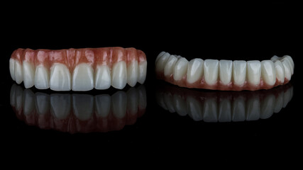 two excellent dental prostheses for the patient's upper and lower jaws on a black background with reflection
