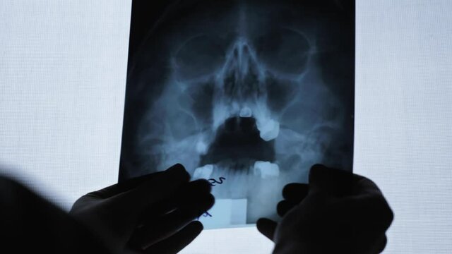 X-ray of the human skull / Magnetic resonance imaging of an older man close-up. Tomographic image of the head