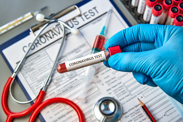 Test tube in hand with a negative blood test for COVID-19 on the background of the analysis form. Blood test for the presence of antibodies to the causative agent of a new coronavirus infection.