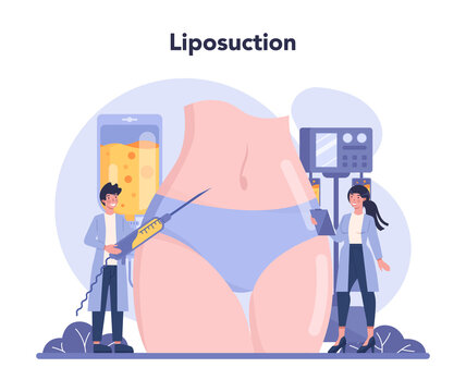 Liposuction Abstract Concept Vector Lipo Procedure, Vacuum, 43% OFF