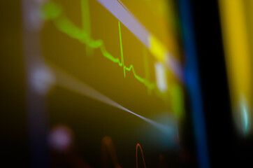 EKG