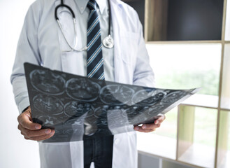 Doctor hands holding patient brain x-ray film before treatment and analyzing treat method