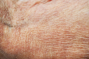Close-up of skin of hands of 90 year old woman for background and texture.