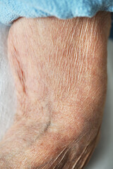 Close-up of skin of hands of 90 year old woman for background and texture.