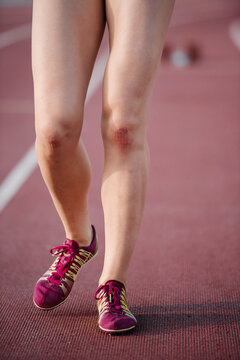 Female athlete with injured knees walking on race track